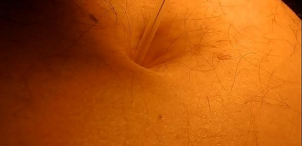  Belly Play piercing with acupuncture needles